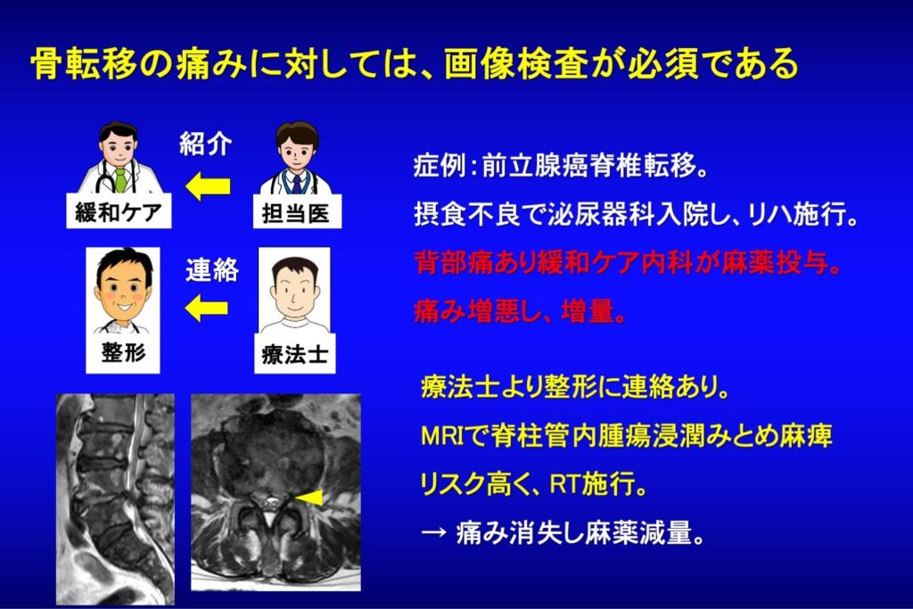 リハビリ中を含め、日常の診療で脊椎転移による背部痛をみのがさないために